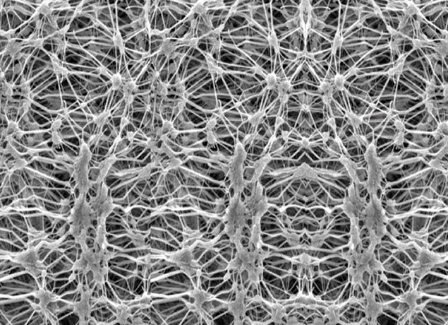 What is the ePTFE Barrier Membrane?